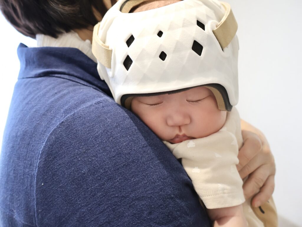 ヘルメット治療をする赤ちゃん